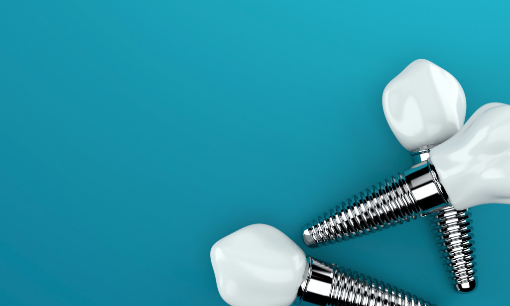 Dental implants on a blue background